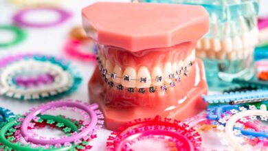 The Role of One Band Space Maintainers in Orthodontic Treatment